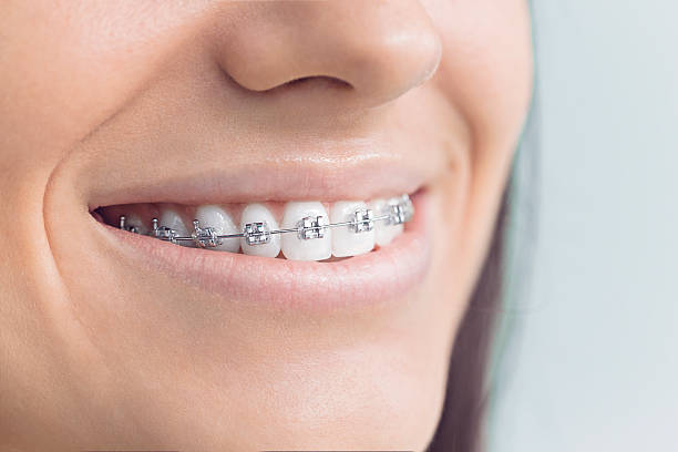 Best Wisdom Tooth Removal  in Lexico, CA